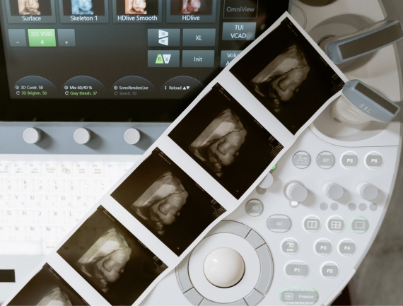 Precios de ultrasonido 3d y 4d en ciudad de mexico